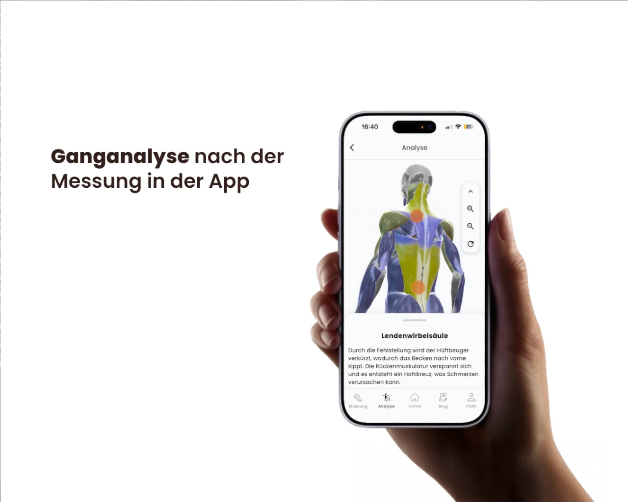 Ganganalyse + 0°-Sohlen